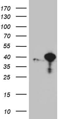 RFC3 Antibody (clone OTI2E5)