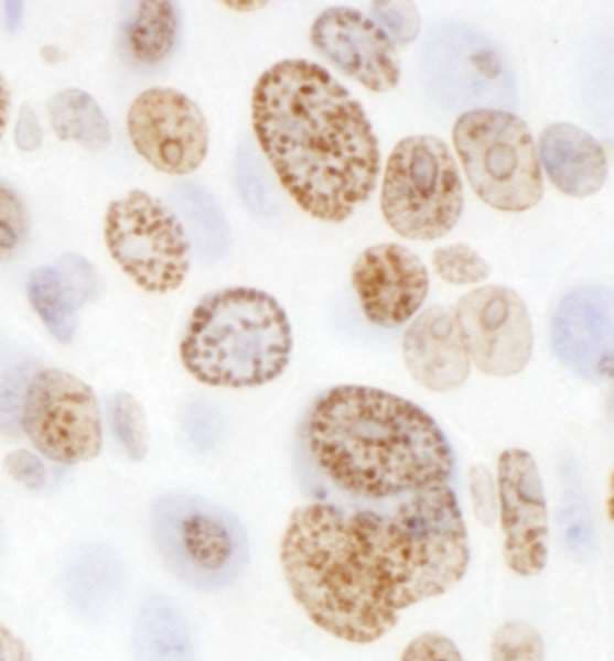 H2AFX / H2AX Antibody (C-Terminus)