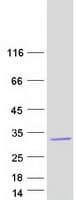 Human STYX Protein (Recombinant Myc-DDK (Flag))