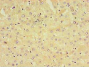 GRA1 / Dense granule protein 1 Antibody