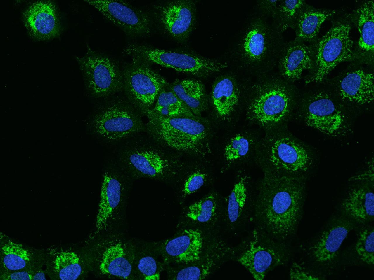 MRPS5 Antibody
