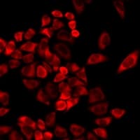 TMLHE / TMID Antibody