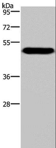 VISA / MAVS Antibody