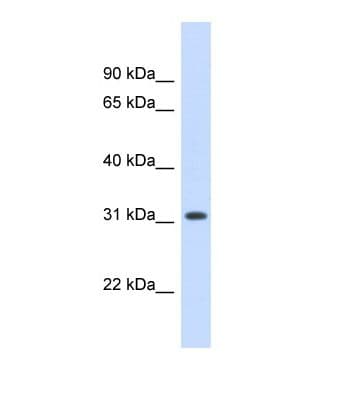 HDS / DHDDS Antibody (aa218-267)