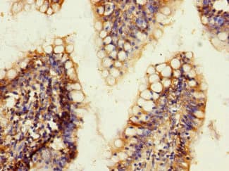 ADGRL2 / LPHN2 Antibody