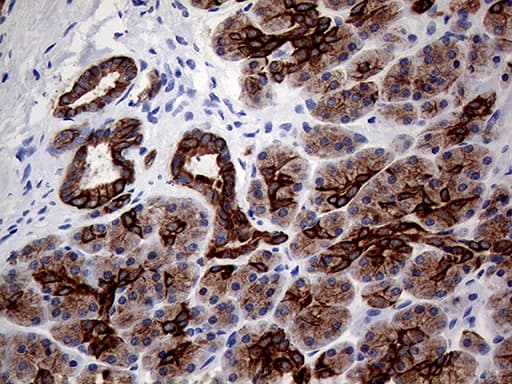KRT8 / CK8 / Cytokeratin 8 Antibody (aa91-381, clone OTI2F5)