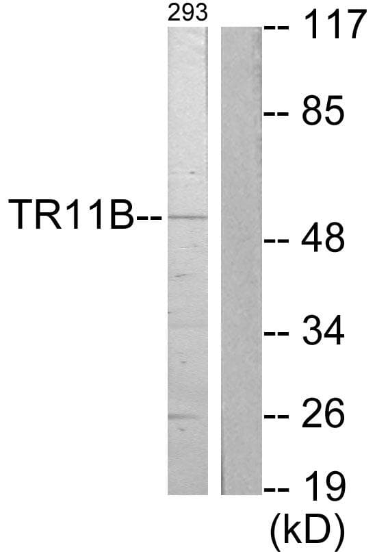 Polyclonal Rabbit anti-Human OPG / Osteoprotegerin Antibody (WB)