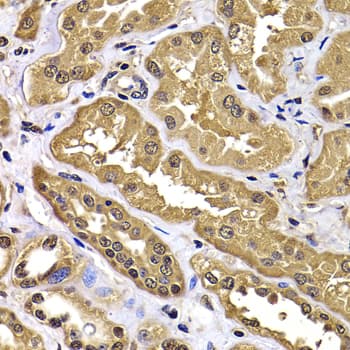 Polyclonal Rabbit anti-Human WBSCR22 Antibody (IHC, IF, WB)
