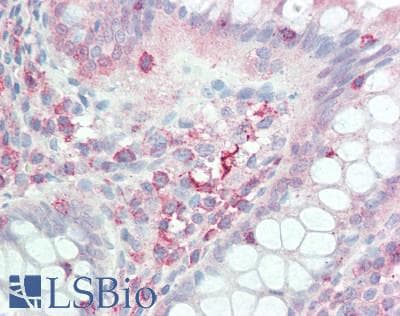 IHC-plus™ Polyclonal Goat anti-Human IL17D Antibody (IHC, WB)