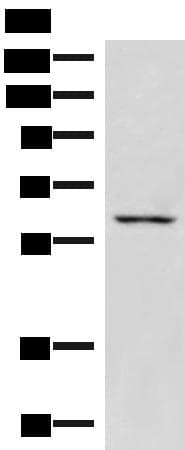 JRKL Antibody