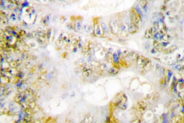 CTNNB1 / Beta Catenin Antibody (Phe660)