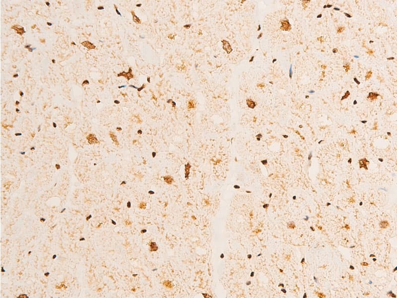 TP73 / p73 Antibody (phospho-Tyr99)