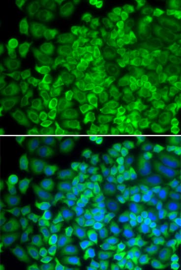 IHC-plus™ GLA / Alpha Galactosidase Antibody (aa150-429)
