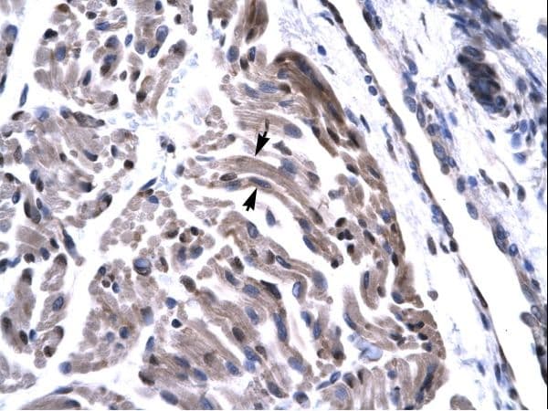 TAF15 Antibody (aa42-91)