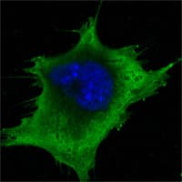 SOD1 / Cu-Zn SOD Antibody (clone 6F5)