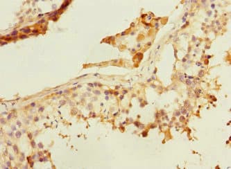 PLK3 Antibody