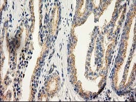 CAT / Catalase Antibody (clone OTI3C3)