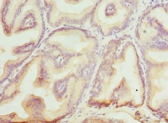 BLVRA Antibody