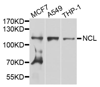 NCL / Nucleolin Antibody