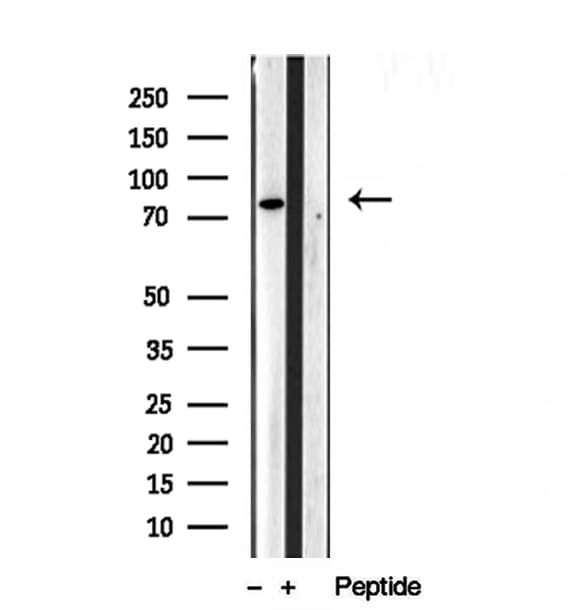 PLOD3 Antibody