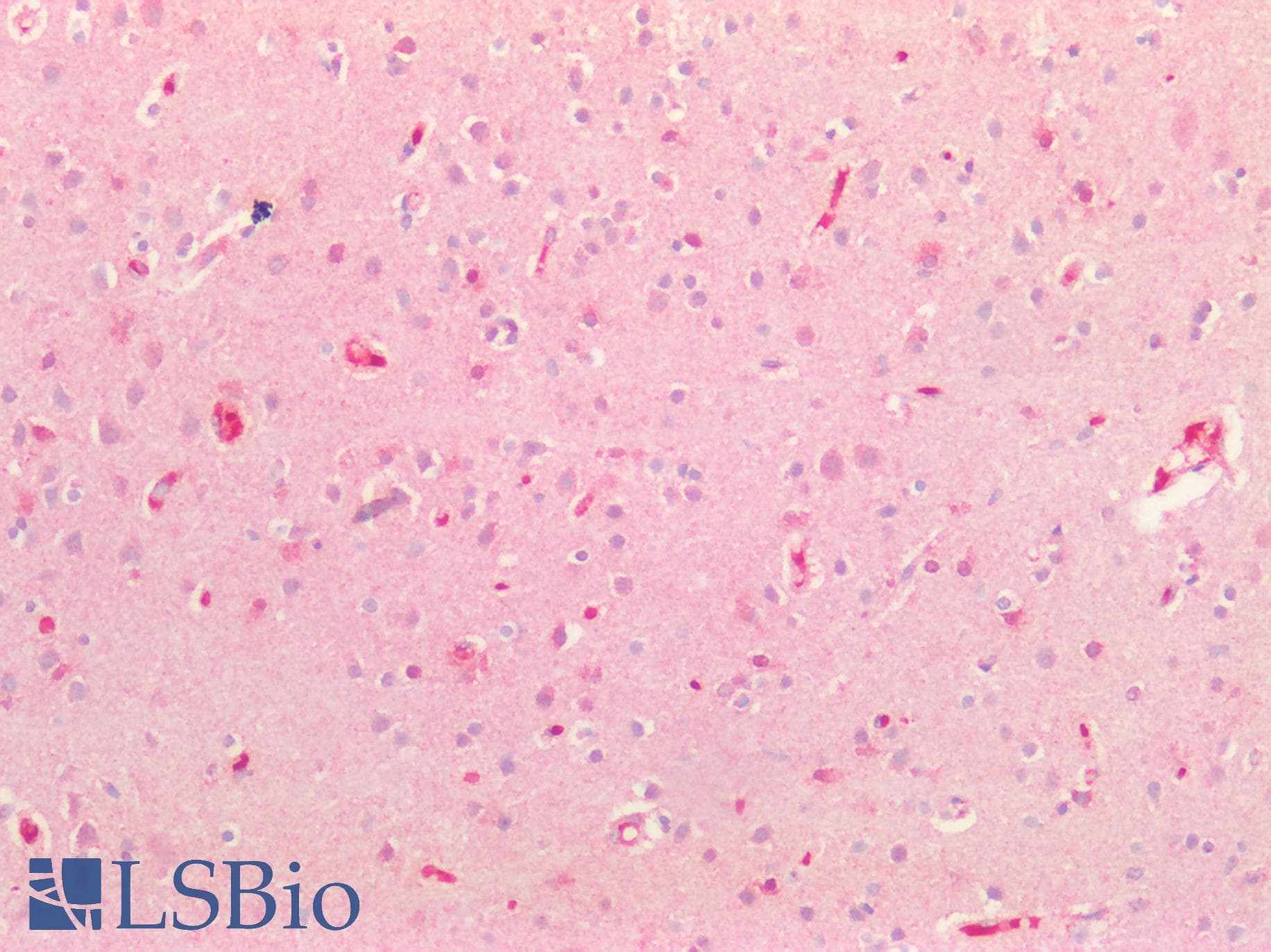IHC-plus™ Polyclonal Rabbit anti-Human FGF9 Antibody (IHC, IF, WB)