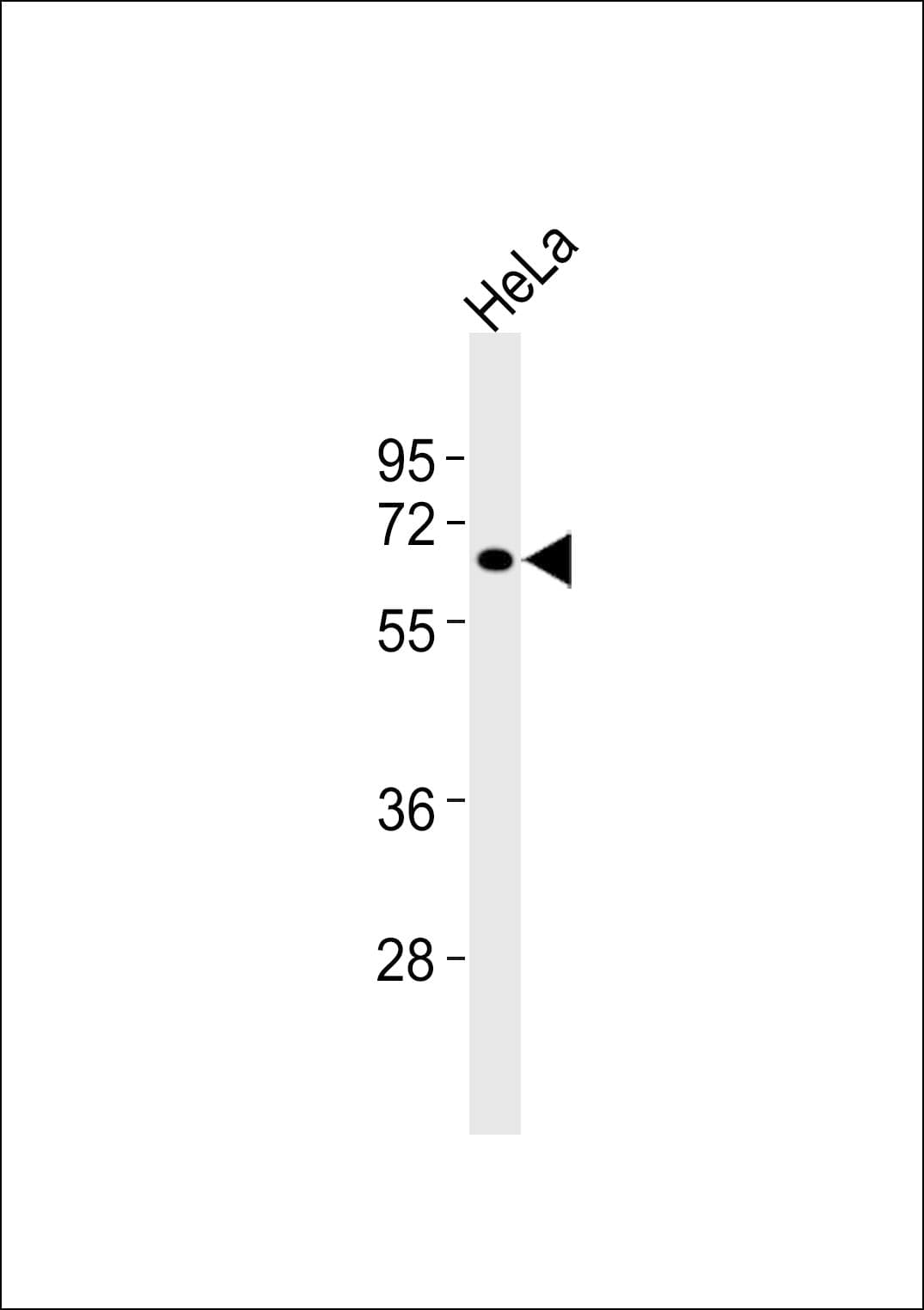 Complement C1R Antibody