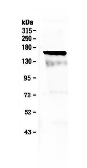 Polyclonal Rabbit anti-Mouse CD135 / FLT3 Antibody (IHC, WB)