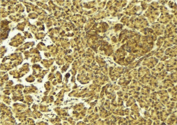 Polyclonal Rabbit anti-Human S100A16 Antibody (IHC, IF, WB)