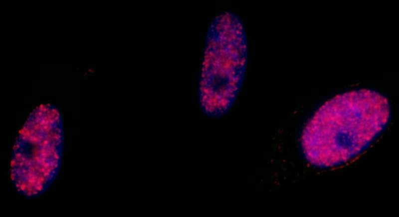 Polyclonal Rabbit anti-Human SMC1A / SMC1 Antibody (phospho-Ser966, IHC, IF, WB)