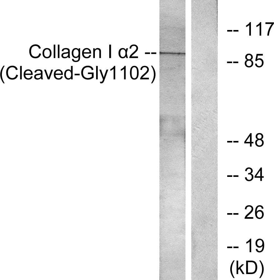 COL1A2 / Collagen I Alpha 2 Antibody (Cleaved-Gly1102)