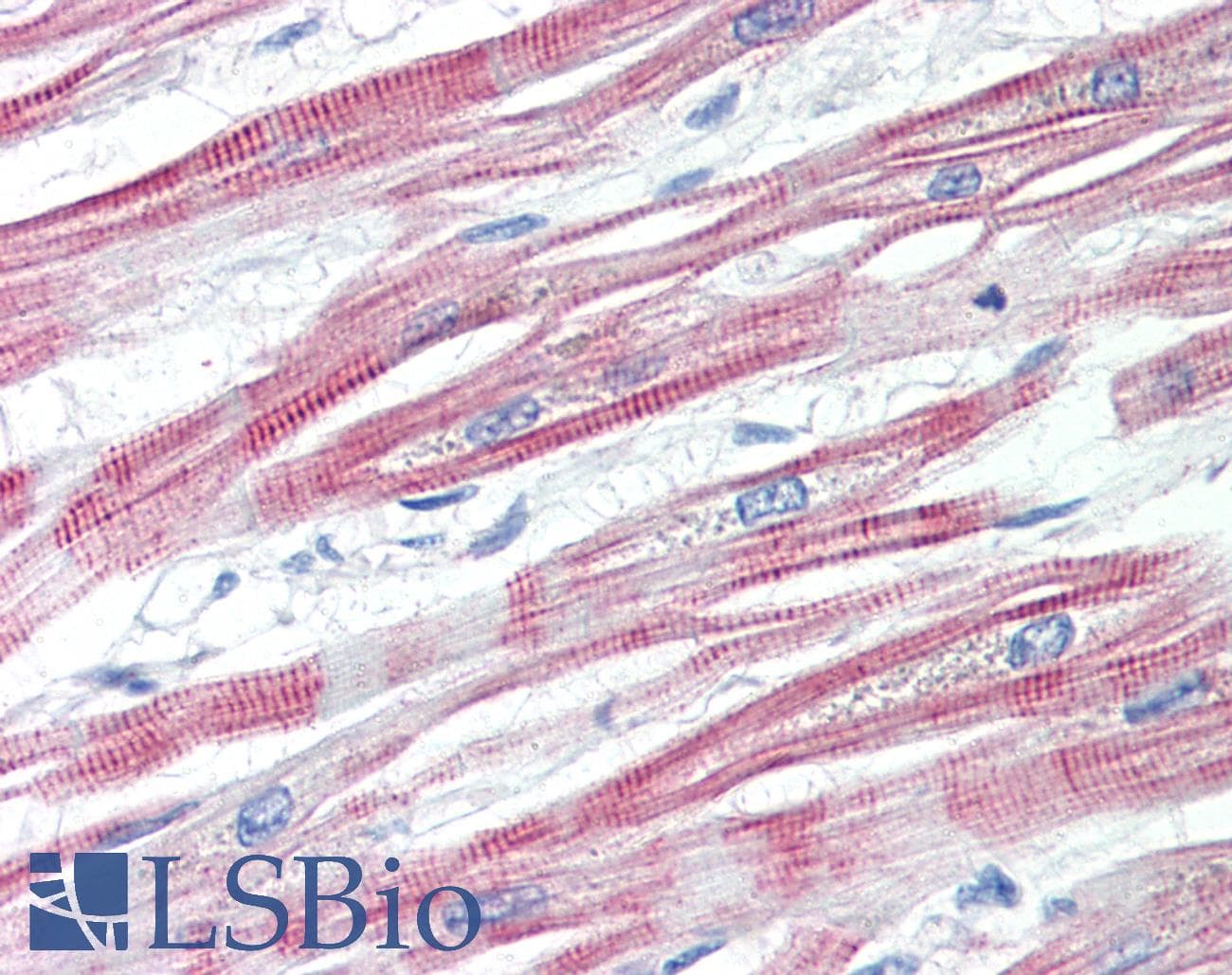 IHC-plus™ EPM2AIP1 Antibody (aa565-579)
