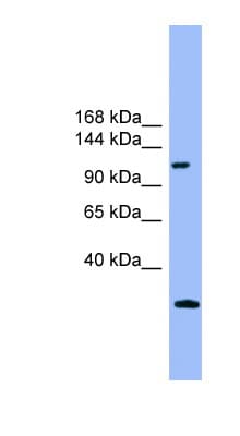 KIAA0226 / RUBICON Antibody (aa311-360)