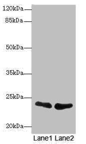 Polyclonal Rabbit anti-Human TNFAIP8 / SCC-S2 Antibody (IHC, WB)