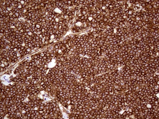 Monoclonal Mouse anti-Human IQGAP1 Antibody (clone OTI5F9, aa464-609, IHC, WB)