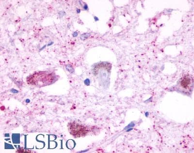 PathPlus™ HTR4 / 5-HT4 Receptor Antibody (Cytoplasmic Domain)