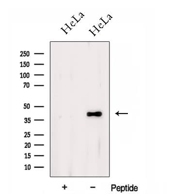 Polyclonal Rabbit anti-Human DSN1 Antibody (WB)