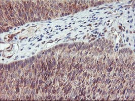 AGPAT5 Antibody (clone OTI1D12)