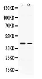 Polyclonal Rabbit anti-Human ABHD5 Antibody (IHC, WB)