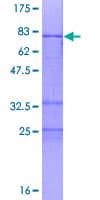 Human ZNF331 Protein (Recombinant GST)