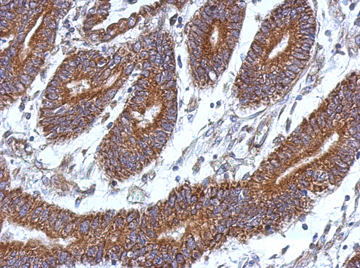 CCDC37 Antibody
