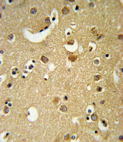 GABRA2 Antibody (aa378-406)