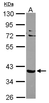 Polyclonal Rabbit anti-Human SLC9A3R2 / SIP1 Antibody (aa82-307, WB)