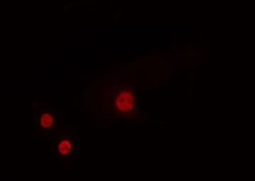 Polyclonal Rabbit anti-Human HOXA1 Antibody (IF, WB)