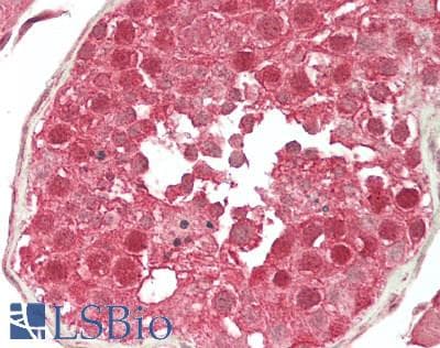 IHC-plus™ RIF1 Antibody (aa2425-C-term)