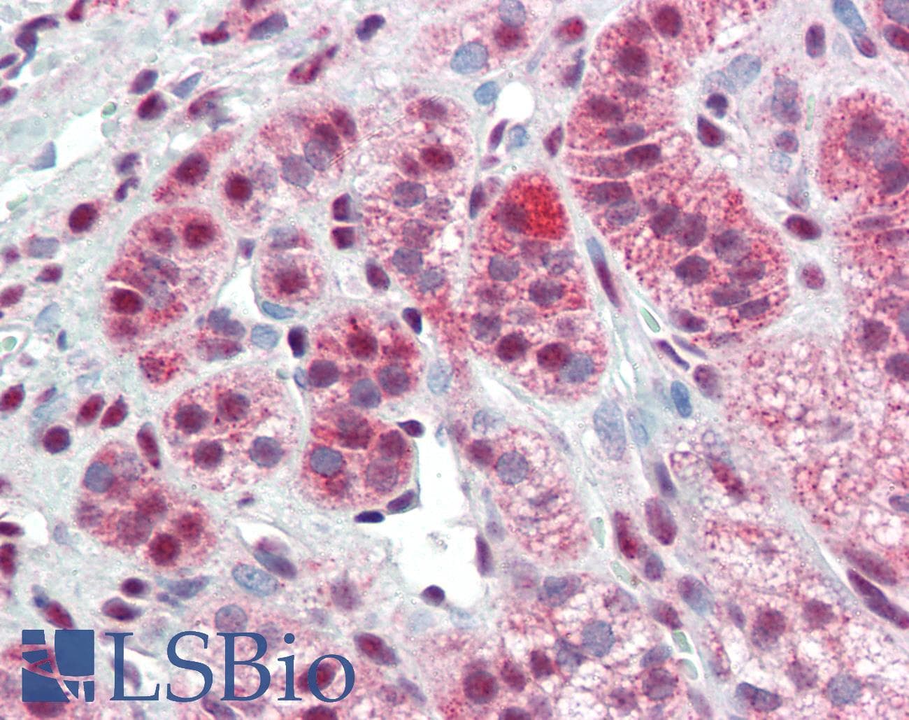 BCL6 Antibody (Internal)