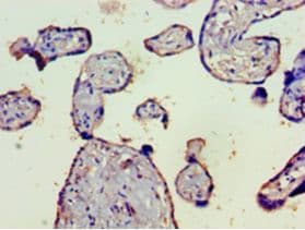 Complement C4b Antibody (aa1454-1744)