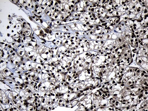 ZNF583 Antibody (clone OTI4H2)