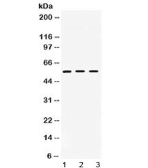Polyclonal Rabbit anti-Human TGFBR1 / ALK5 Antibody (WB)