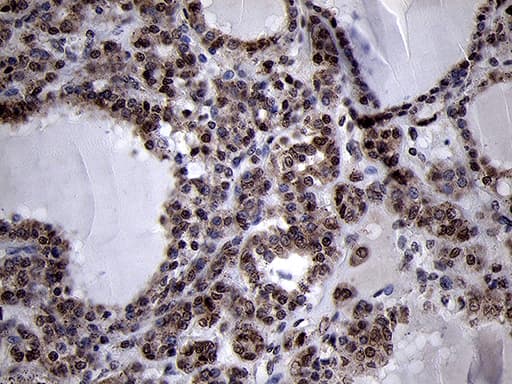 SMC1A / SMC1 Antibody (aa889-1016, clone OTI3G4, Carrier-free)
