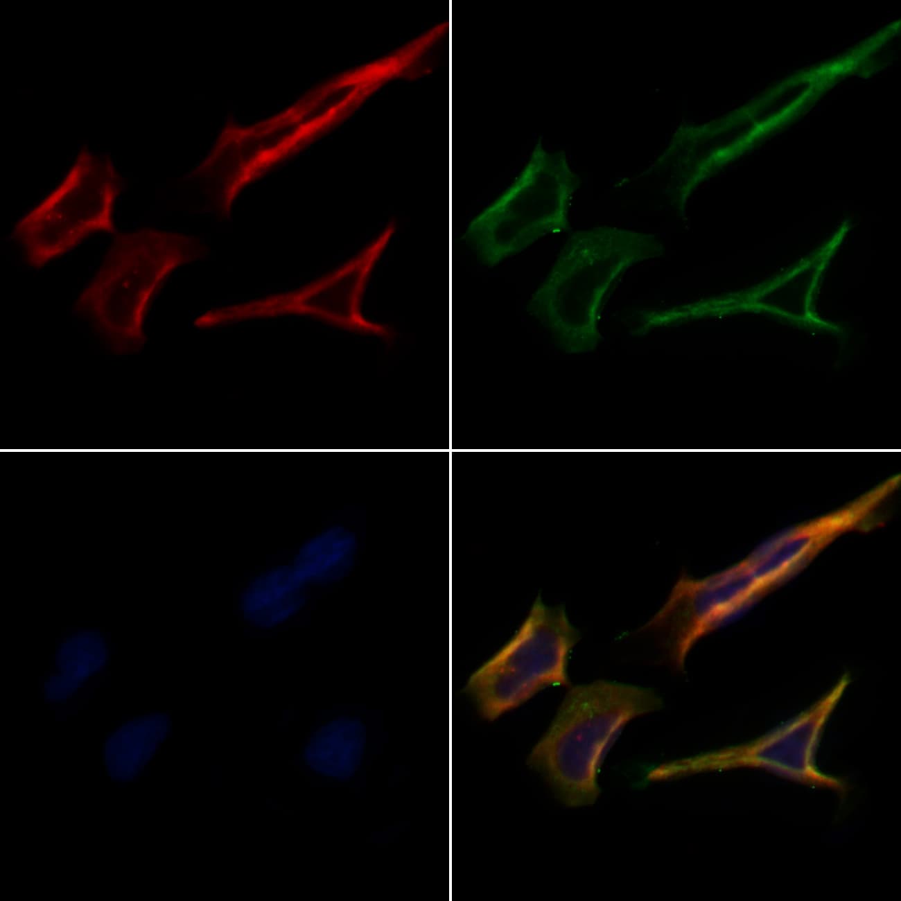 PRRT1 Antibody